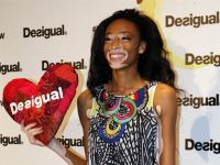 Chantalle Winnie, la primera modelo con vitíligo